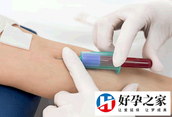 优生5项检查费用多少,优生优育五项检查结果