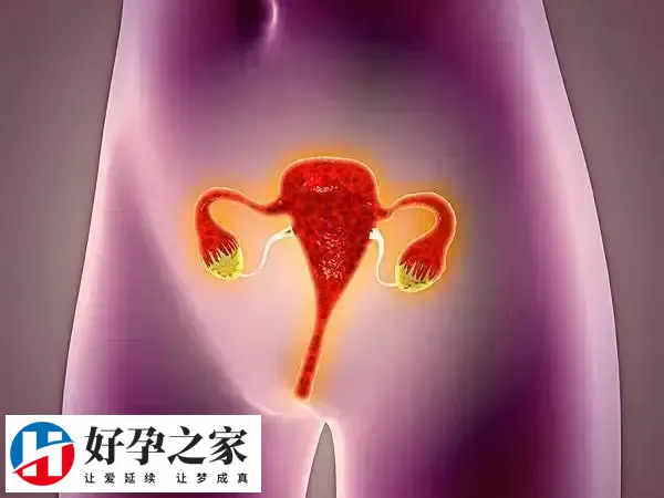 月经不调是多囊症状之一