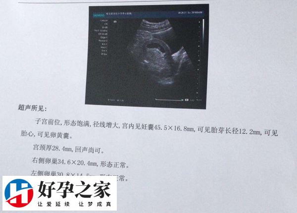 b超二维三维四维的差异