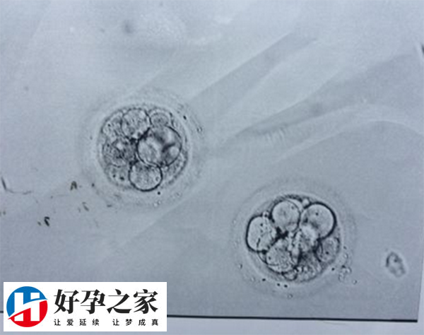 做第三代试管胚胎筛查后一般还剩几个能用