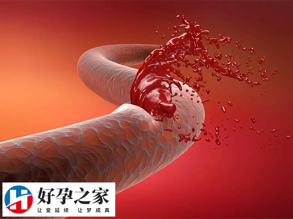 试管移植用磺达肝癸钠的作用是什么